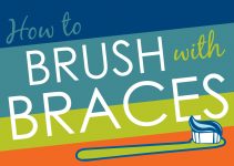 How to Brush with Braces Epic Orthodontics